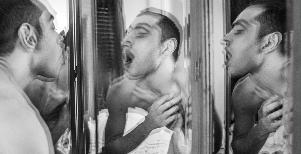 Κουνελόκολλα